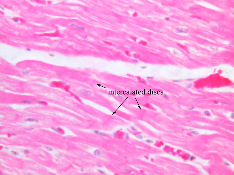 Cardiac Muscle Tissue Slide Labeled