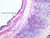 a74 bronchus 10x labeled.jpg