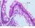 b12 simple columnar epithelium jejunum 40x labeled.jpg