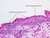 a49b keratinized stratified squamous epithelium skin 40x labeled.jpg