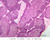 a46 adolescent thymus 2x labeled.jpg