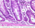 b12 lymphatic vessel jejunum 40x labeled.jpg