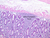 b12 diffuse lymphatic tissue galt jejunum 10x labeled.jpg