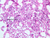 a4b bone marrow 20x labeled.jpg