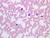 a100 22 blood smear 40x wright.jpg
