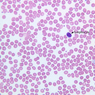 A100, Blood Smear, 40x Labeled (Wright)