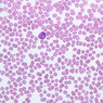 A100, Blood Smear, 40x (Wright)