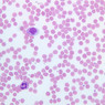 A100, Blood Smear, 40x (Wright)