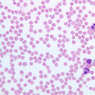A100, Blood Smear, 40x (Wright)