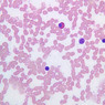 A100, Blood Smear, 40x (Wright)