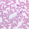 A100, Blood Smear, 40x (Wright)