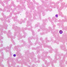 A100, Blood Smear, 40x (Wright)