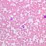 A100, Blood Smear, 40x (Wright)