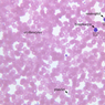 A100, Blood Smear, 40x Labeled (Wright)