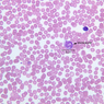 A100, Blood Smear, 40x Labeled (Wright)