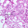 A4, Bone Marrow, 20x Labeled (H&E)