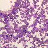 A5, Bone Marrow, 40x (Wright)