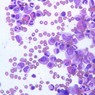 A5, Bone Marrow, 40x (Wright)