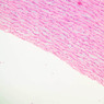 A26, Aorta, 10x (H&E)