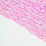 A26, Aorta, 20x (H&E)