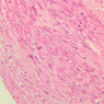 A28, Renal Artery (Kidney), 20x (H&E)