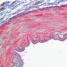 A28, Renal Artery (Kidney), 20x (AF)