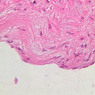 A28, (Kidney) Renal Artery, 40x (H&E)