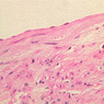 A28, Renal Artery (Kidney), 40x (H&E)
