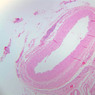 A28, Renal Artery (Kidney), 2.5x (H&E)