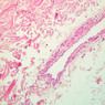 A48, Abdominal Skin, 10x (H&E)