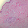 A48, Abdominal Skin, 2.5x (H&E)