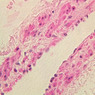 A48, Abdominal Skin, 40x (H&E)