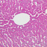 B35, Liver (Sinusoids), 20x (PAS)