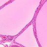 B52, Thyroid, 20x (H&E)