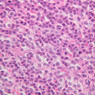 B56, Parathyroid, 40x (H&E)