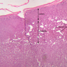 B60, Adrenal Gland, 2.5x Labeled (H&E)