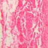 Epithelium
