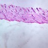 Epithelium