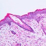 Epithelium