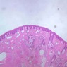 Epithelium
