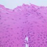 Epithelium