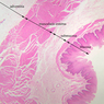 B2, Esophagus, 2.5x Labeled (H&E)