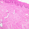 B3, Esophagus, 10x (H&E)