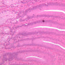 B9, Stomach (Pylorus), 20x (H&E)