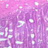 B15, Jejunum, 20x (H&E)