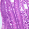 B15, Jejunum, 40x (H&E)