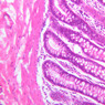 B23, Colon, 20x (H&E)