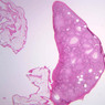 B94, Ovary, 1x (H&E)