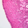 B96, Ovary, 20x (H&E)