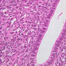 B97, Uterus, 40x (H&E)
